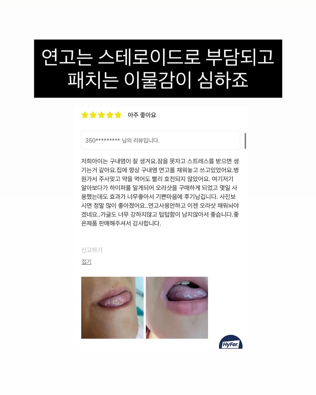 위드토리 의류형 하네스 6
