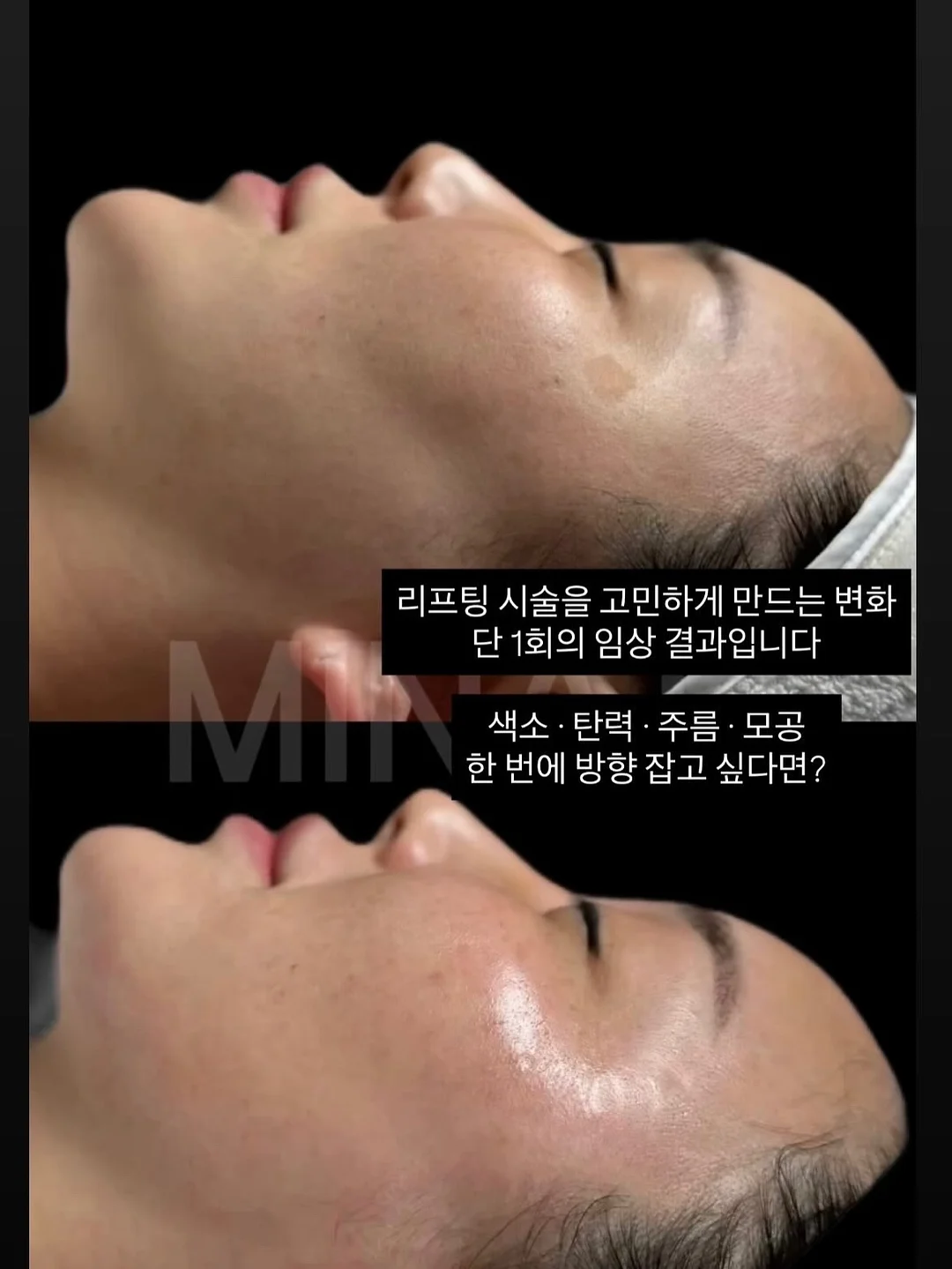 레몬 커드 마들렌 11
