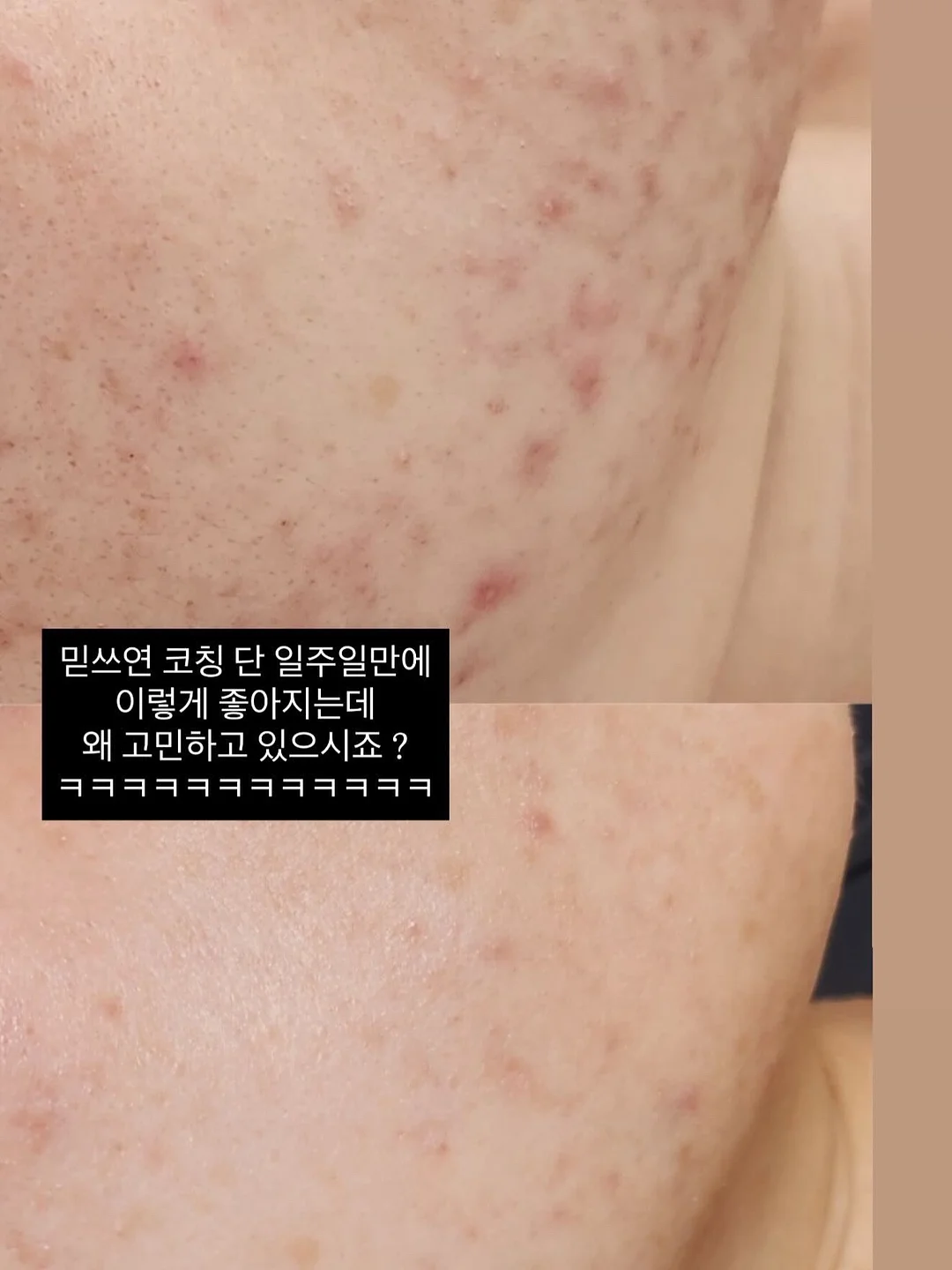 체커보드 배너 2