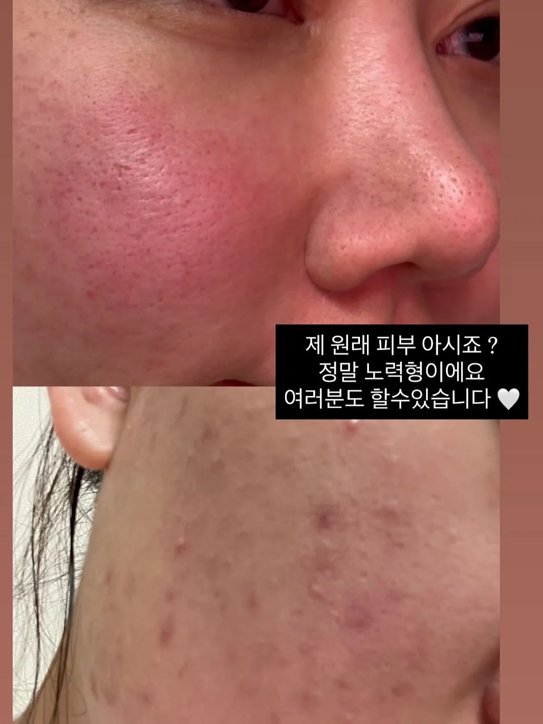 체커보드 배너 3