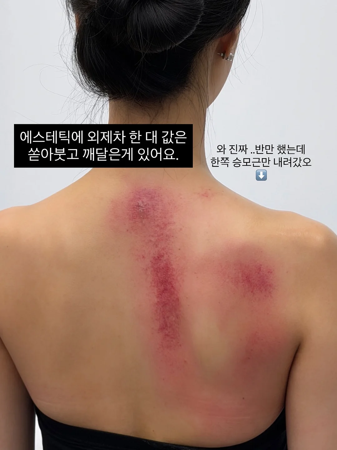 기미 잡티 크림 1