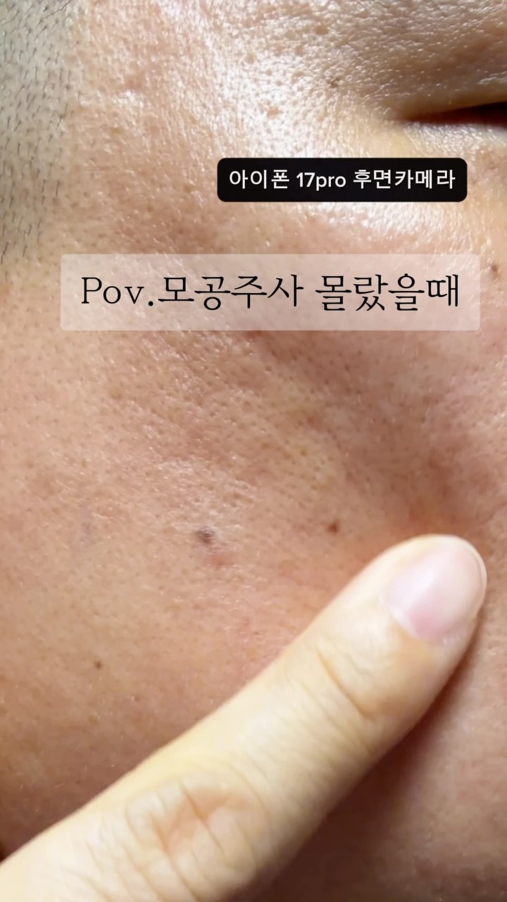 알쿠 고체 탈취제