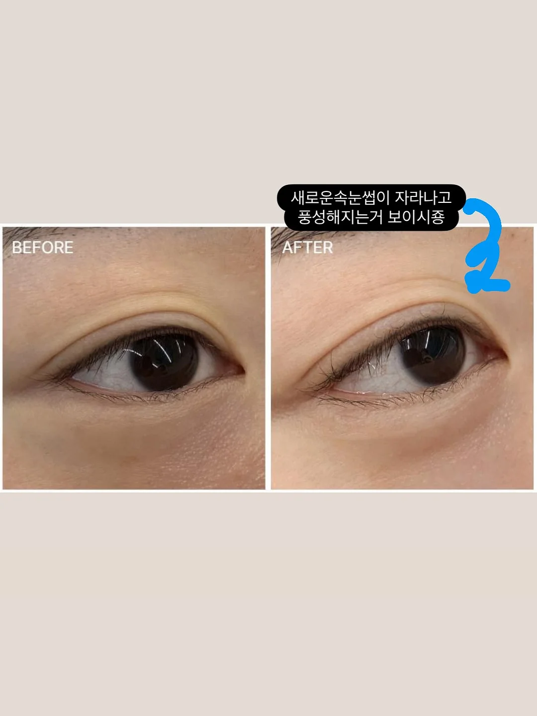 화장실 청소용품 8