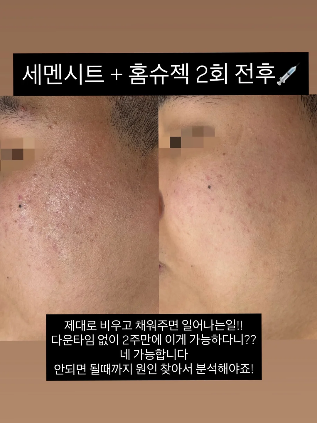 웨딩 스냅 촬영 6