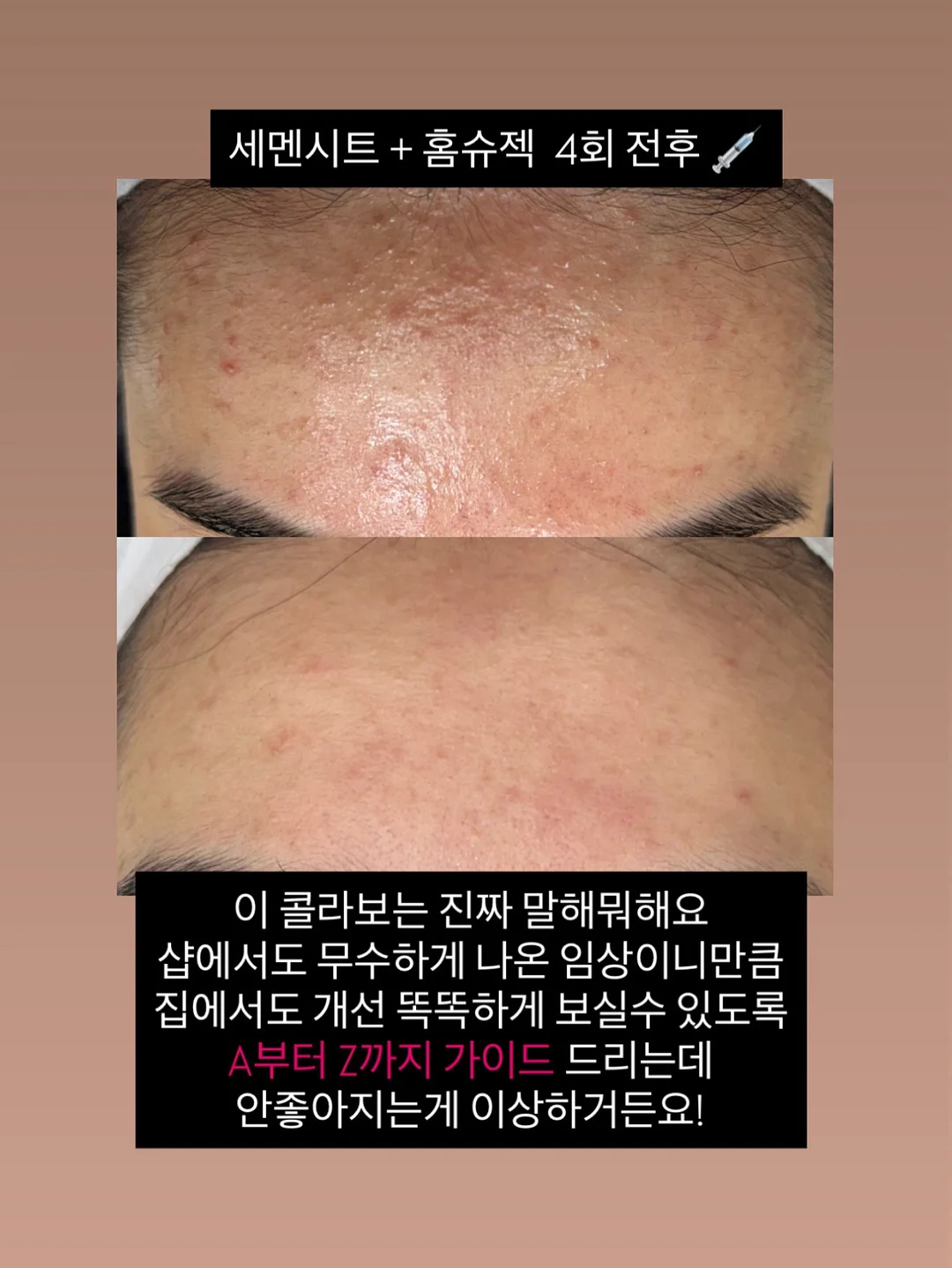 웨딩 스냅 촬영 7