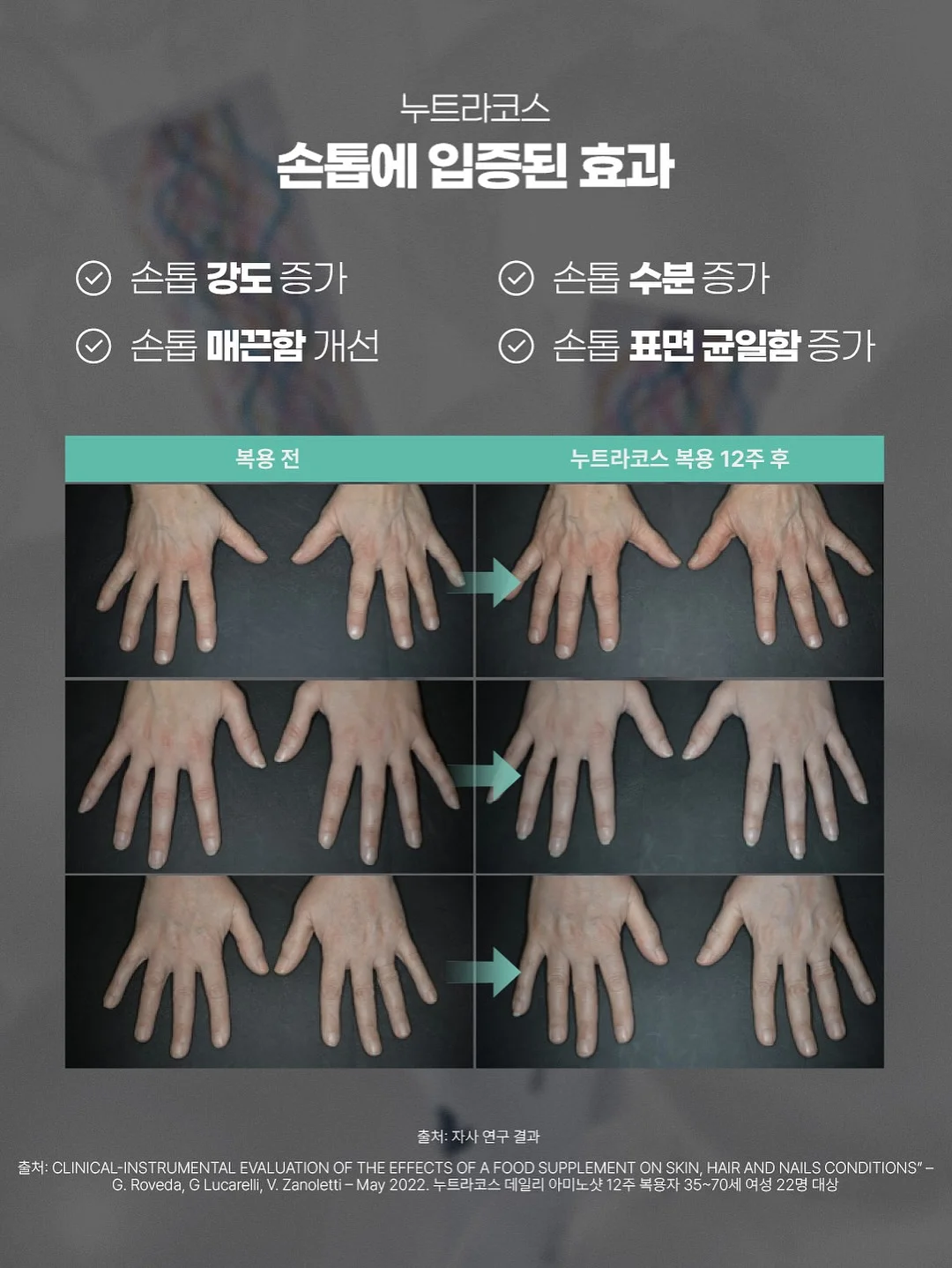 늘씬수 10