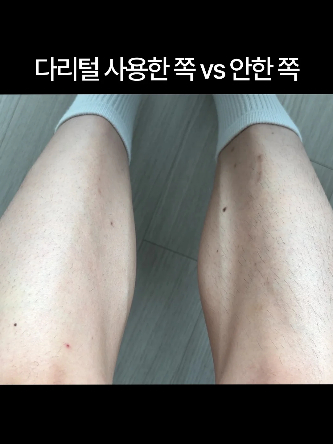 SHARGE ICEMAG 3 보조배터리 3