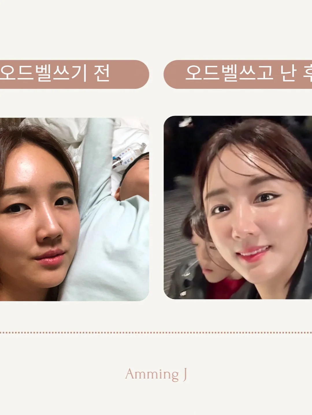 감성 젤리 플랫슈즈 2