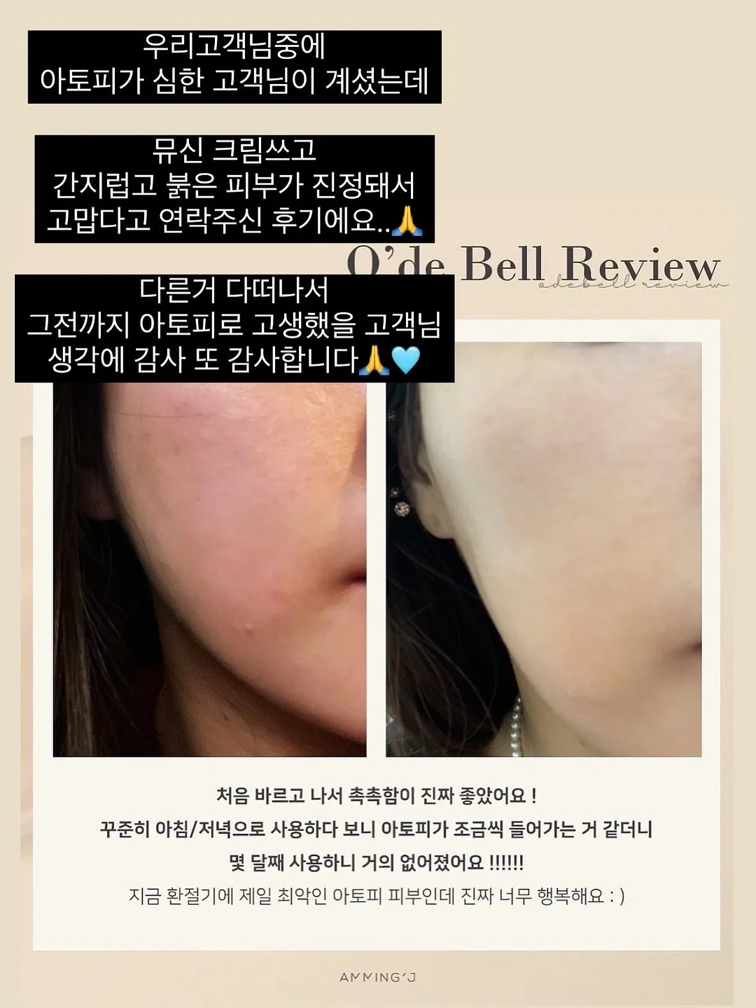 감성 젤리 플랫슈즈 3
