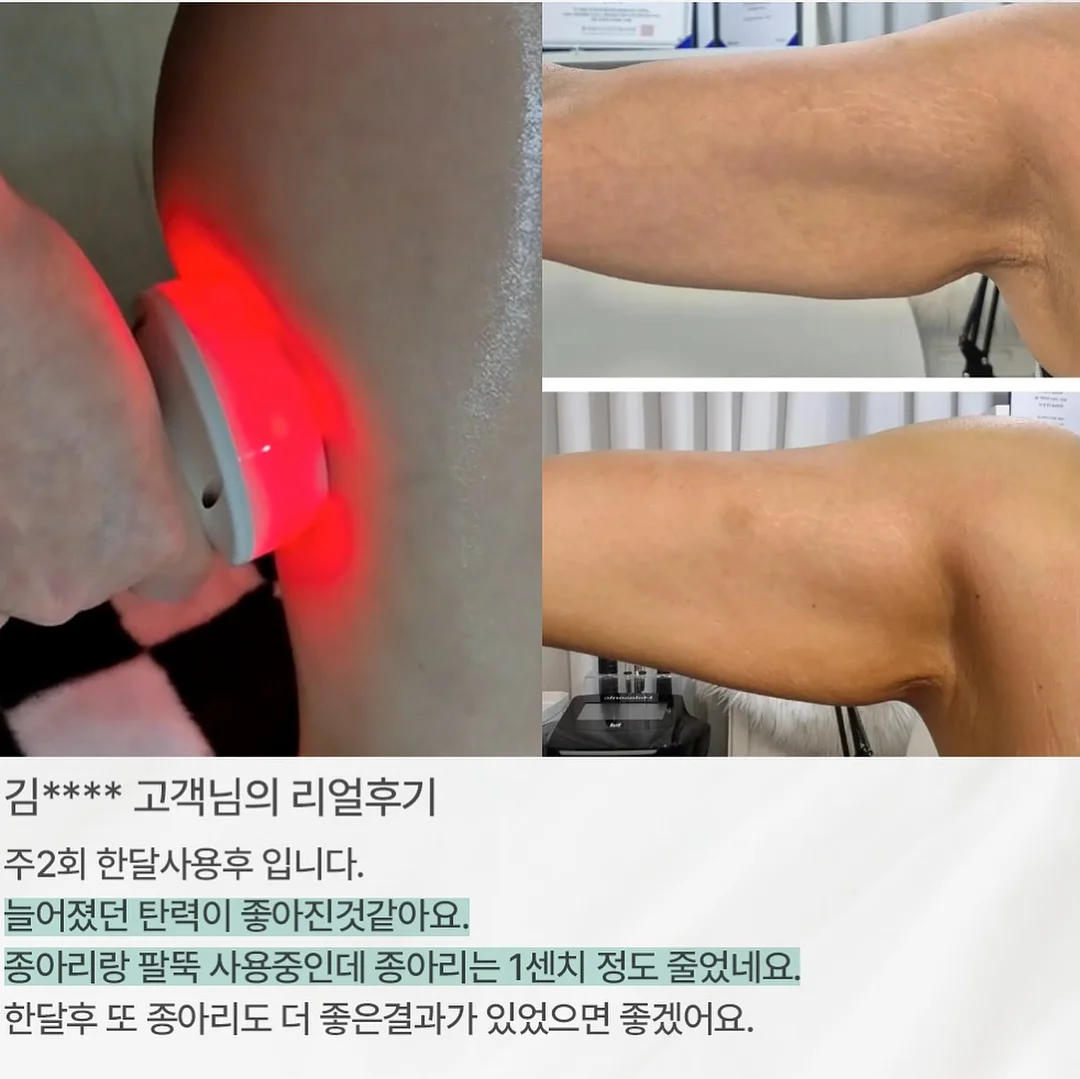 b/d 영상 4
