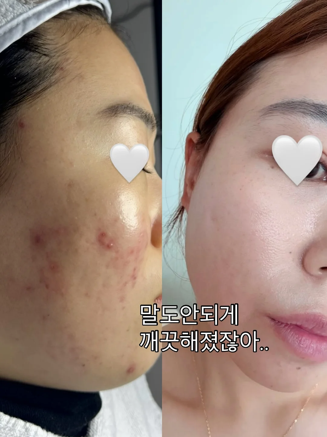 작은 숙소 2