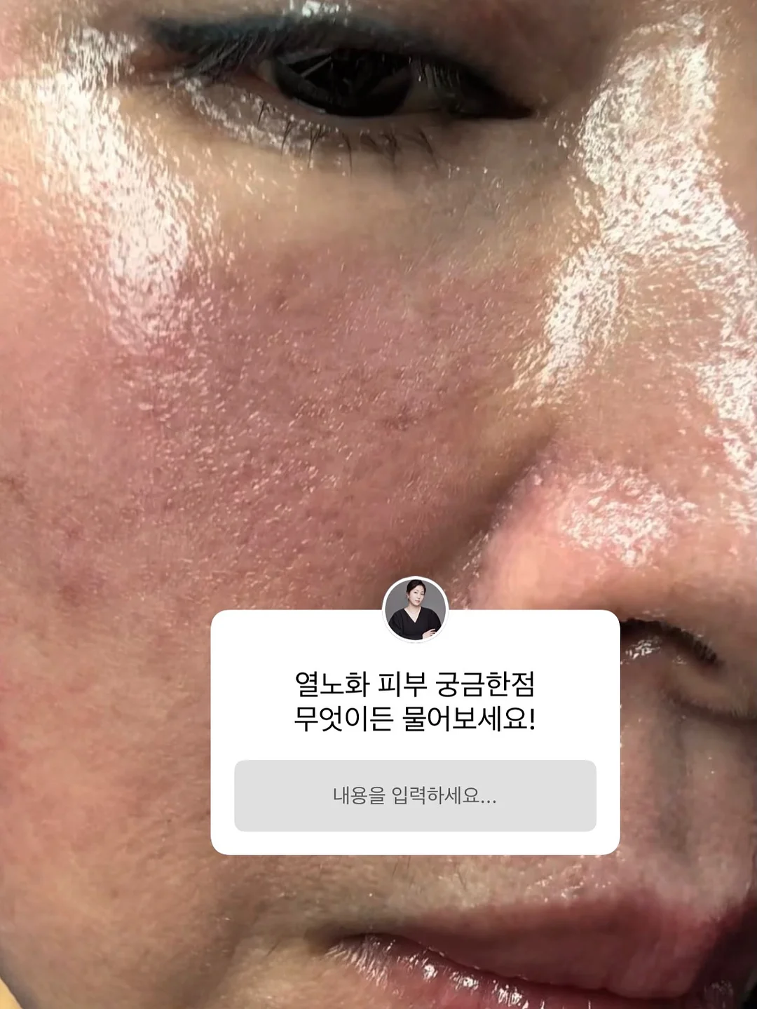 레드루트 캡슐 세제 2