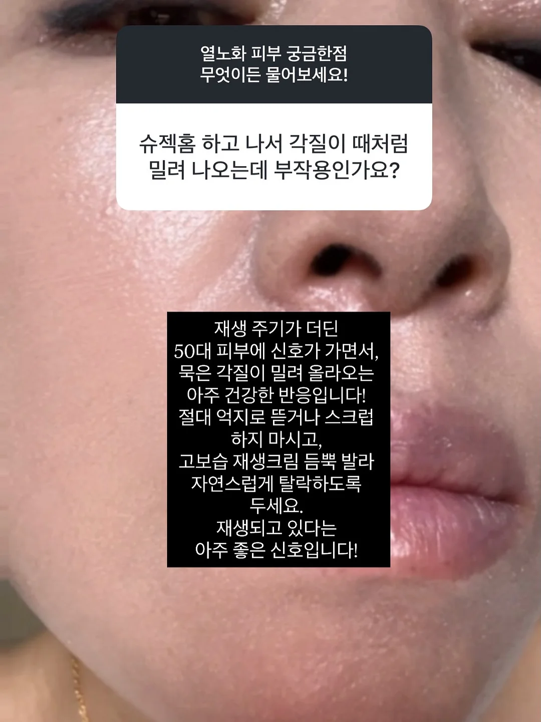 레드루트 캡슐 세제 5
