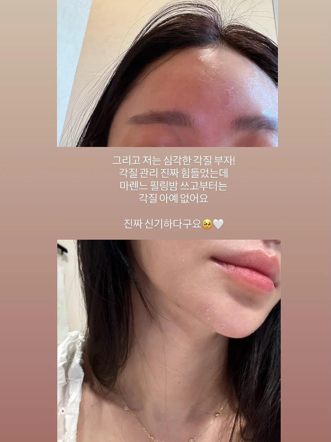 페스티벌 코디 4