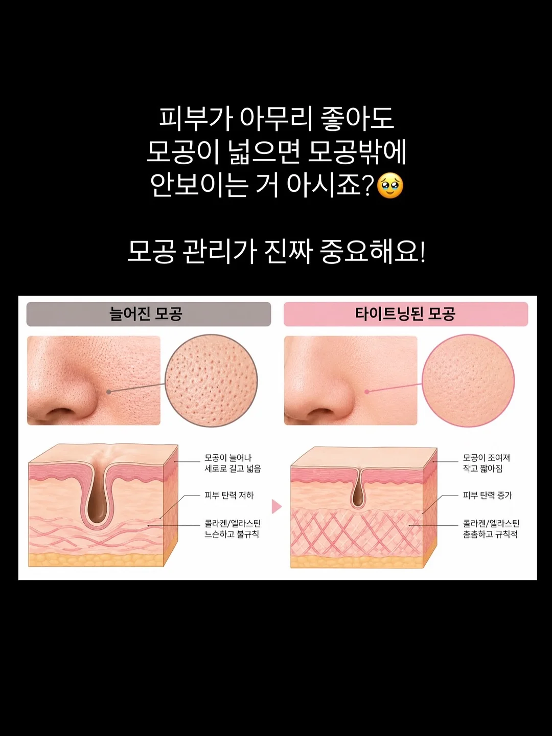 페스티벌 코디 6