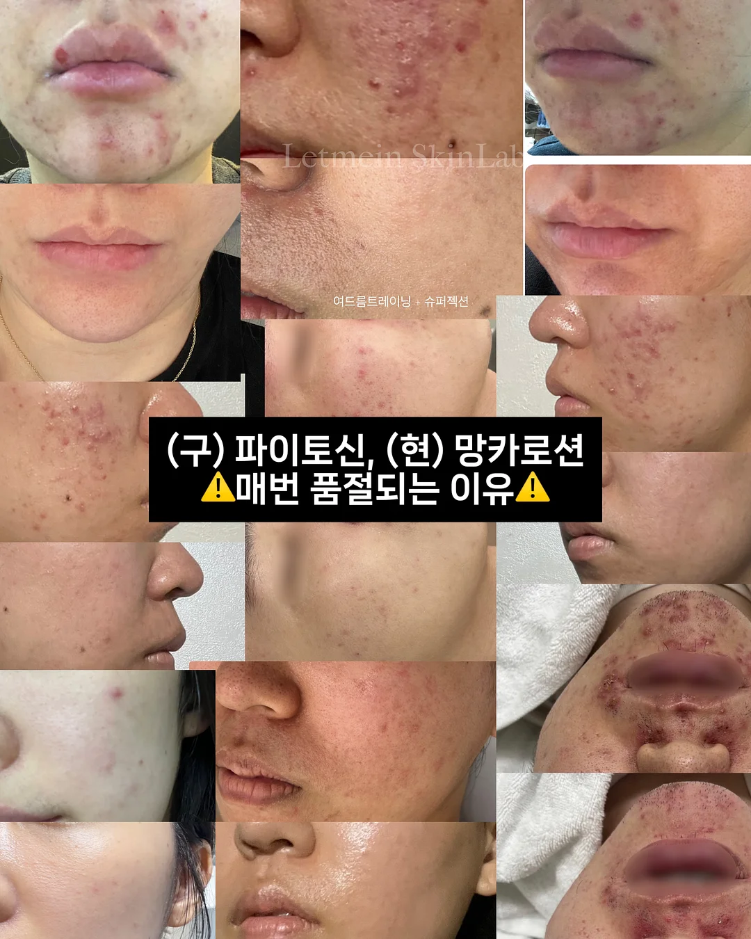 스트랩 셔링 레이어드 블라우스 2