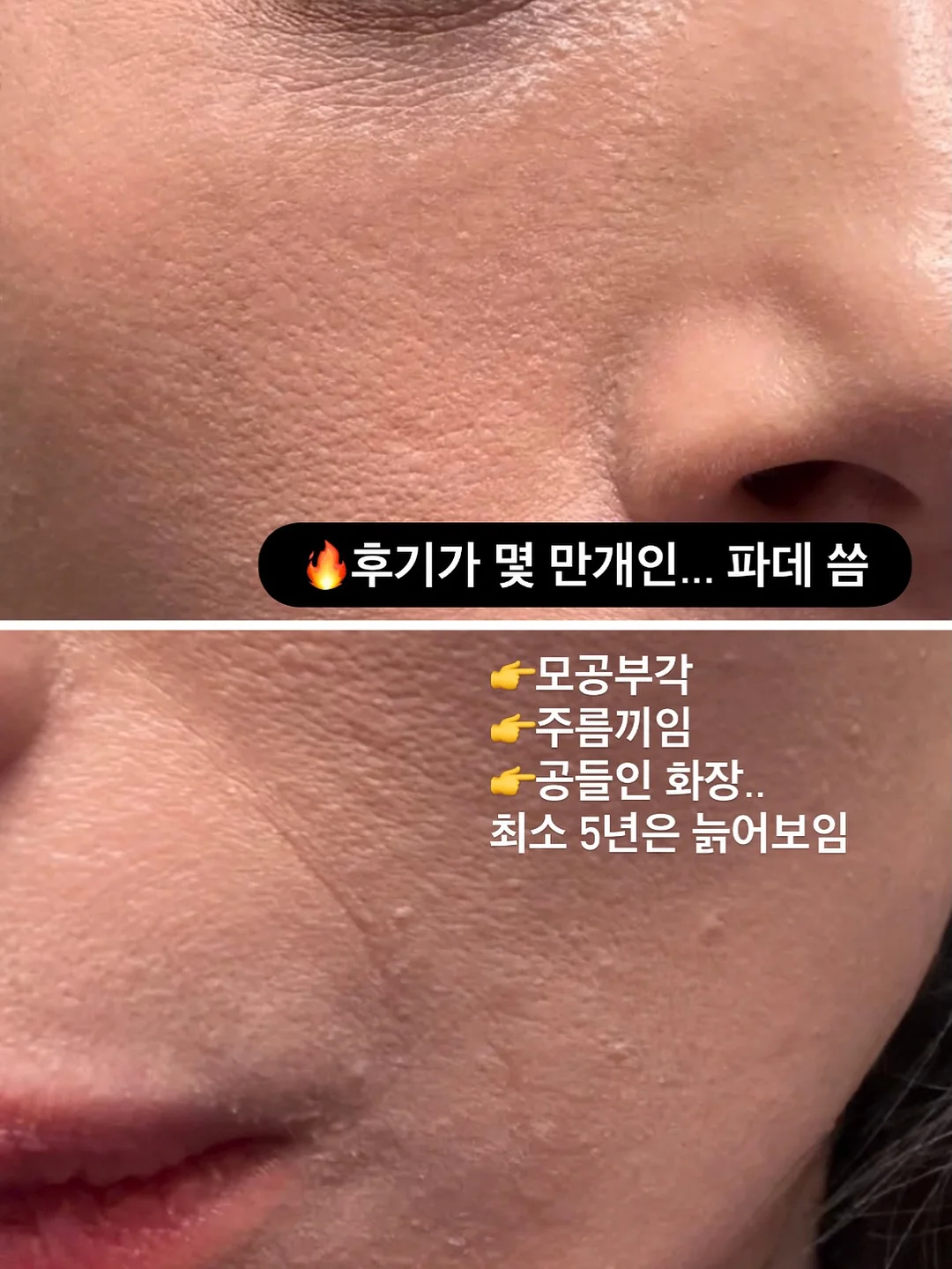 순환디바이스 4