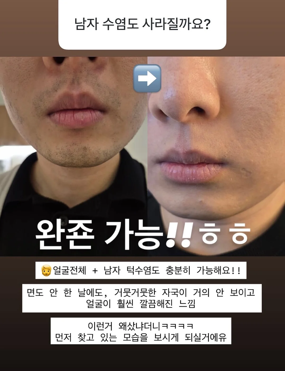 일리윤 아토 로션 1