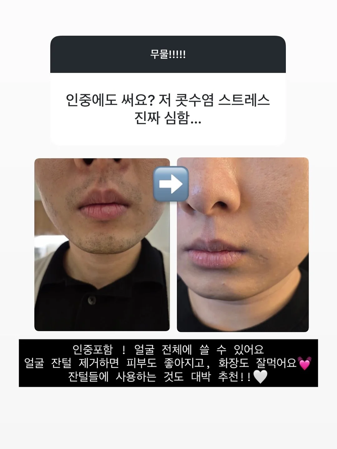 일리윤 아토 로션 2