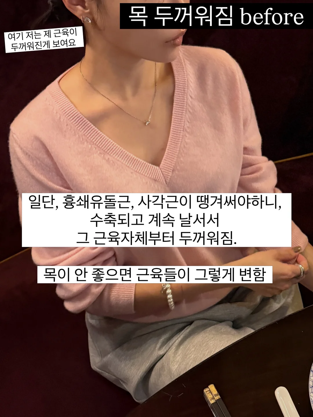 초당옥수수 11
