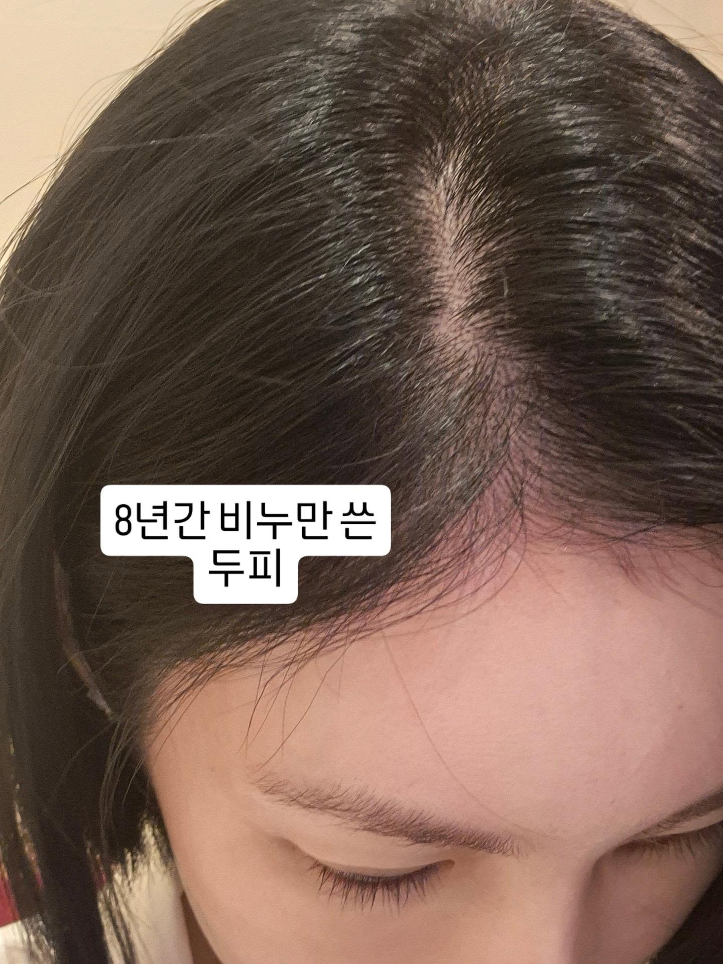 벌레 흡입기 4