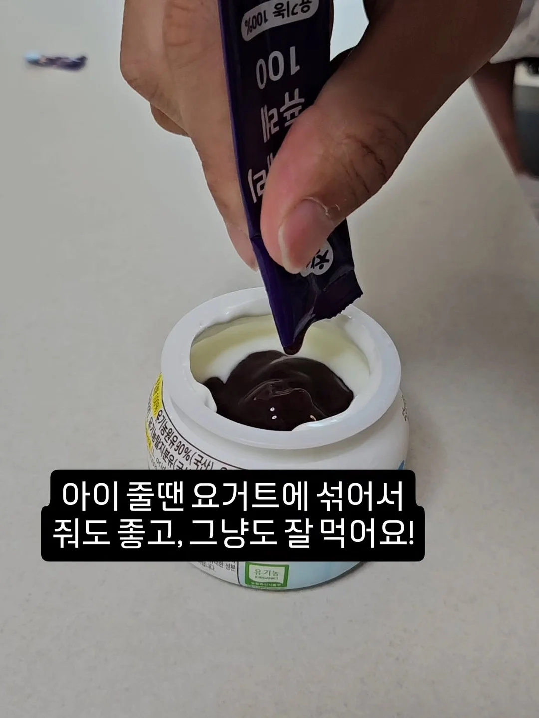 동안 애교살 시술 6