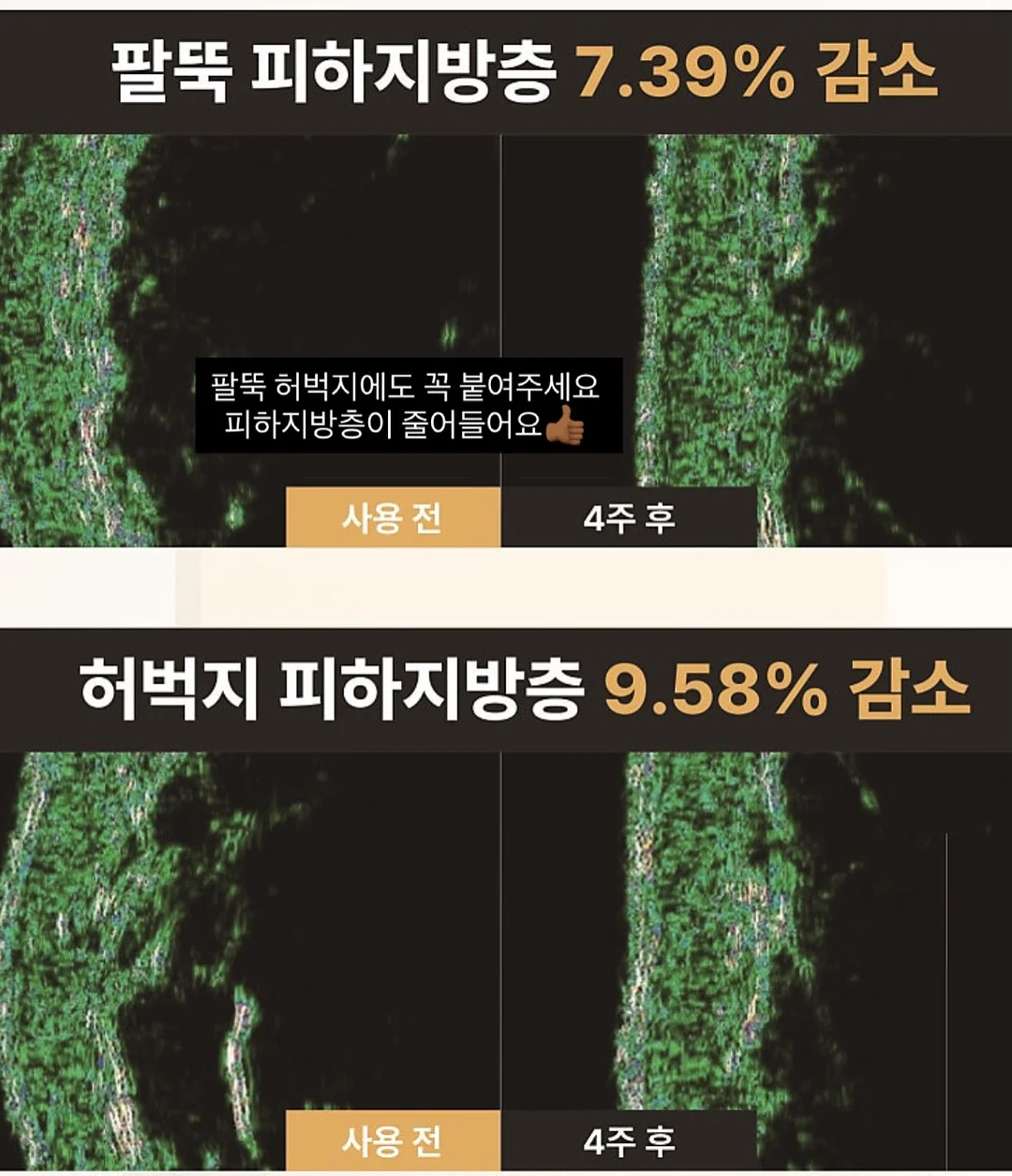 세탁 비누 케이스 4