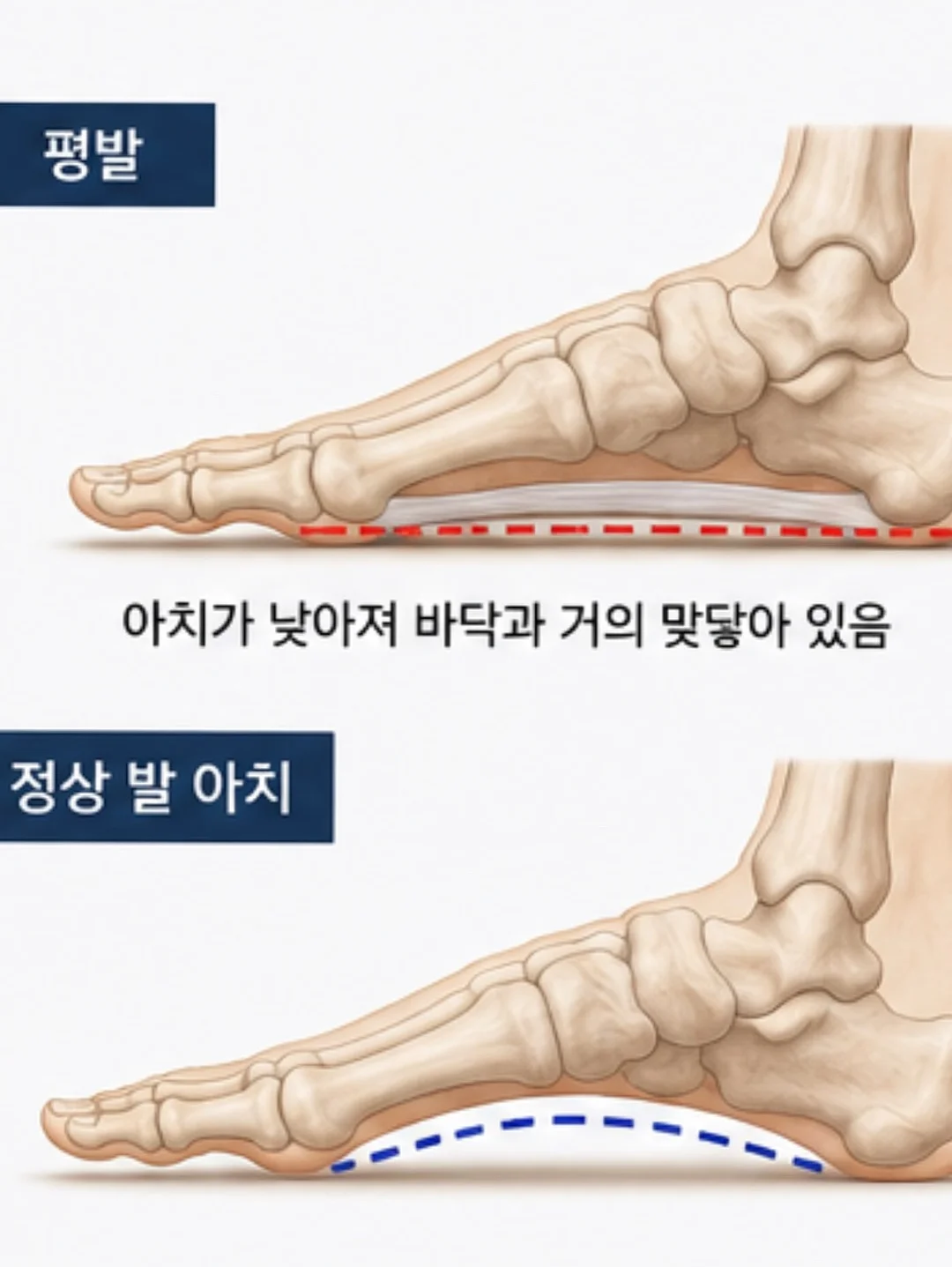 마요르카 버킷햇 패키지 5