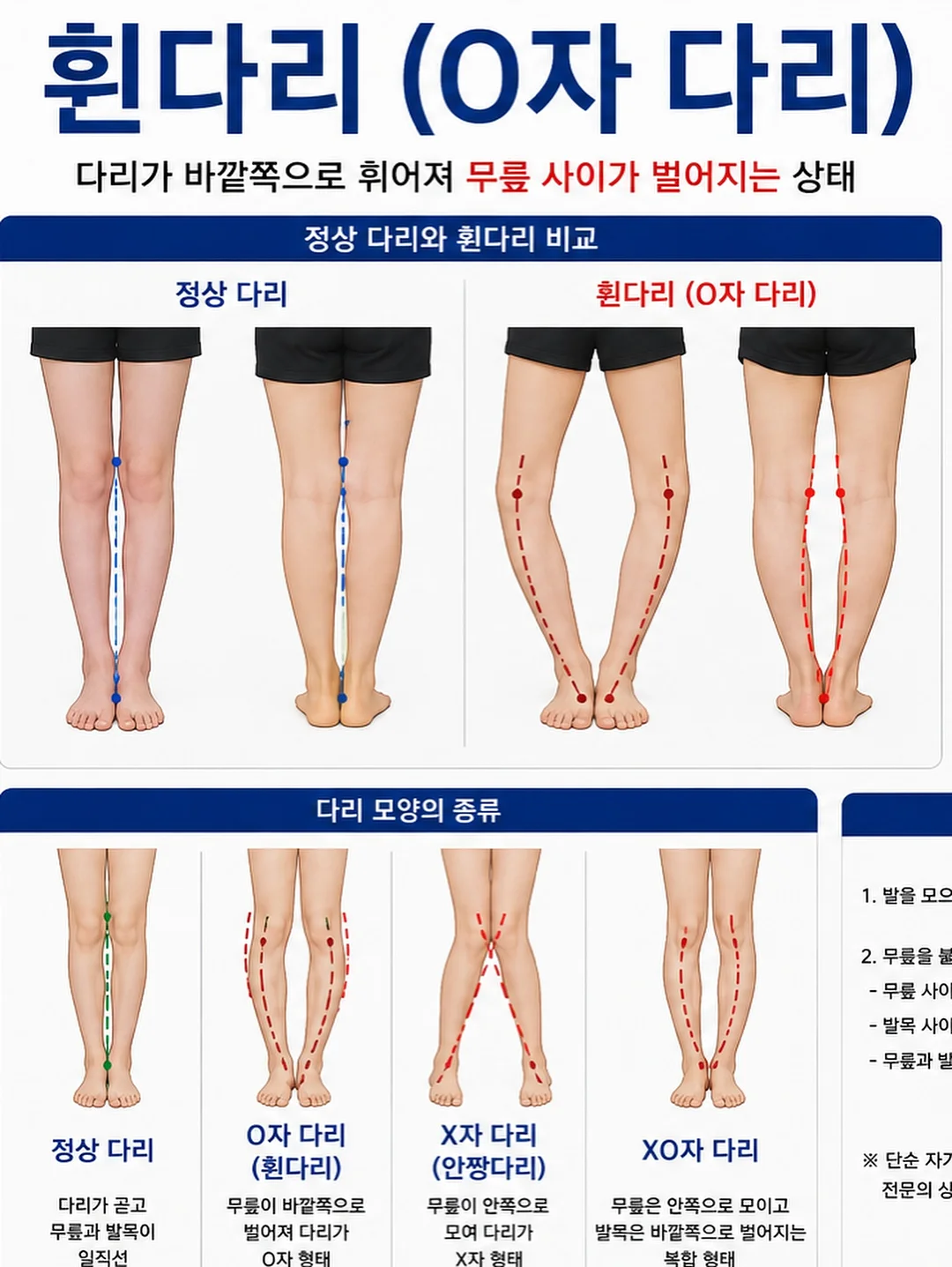 마요르카 버킷햇 패키지 6