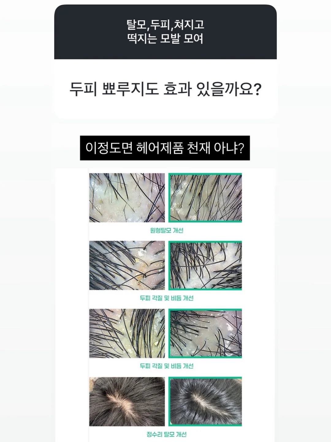 알론느 셔츠 2