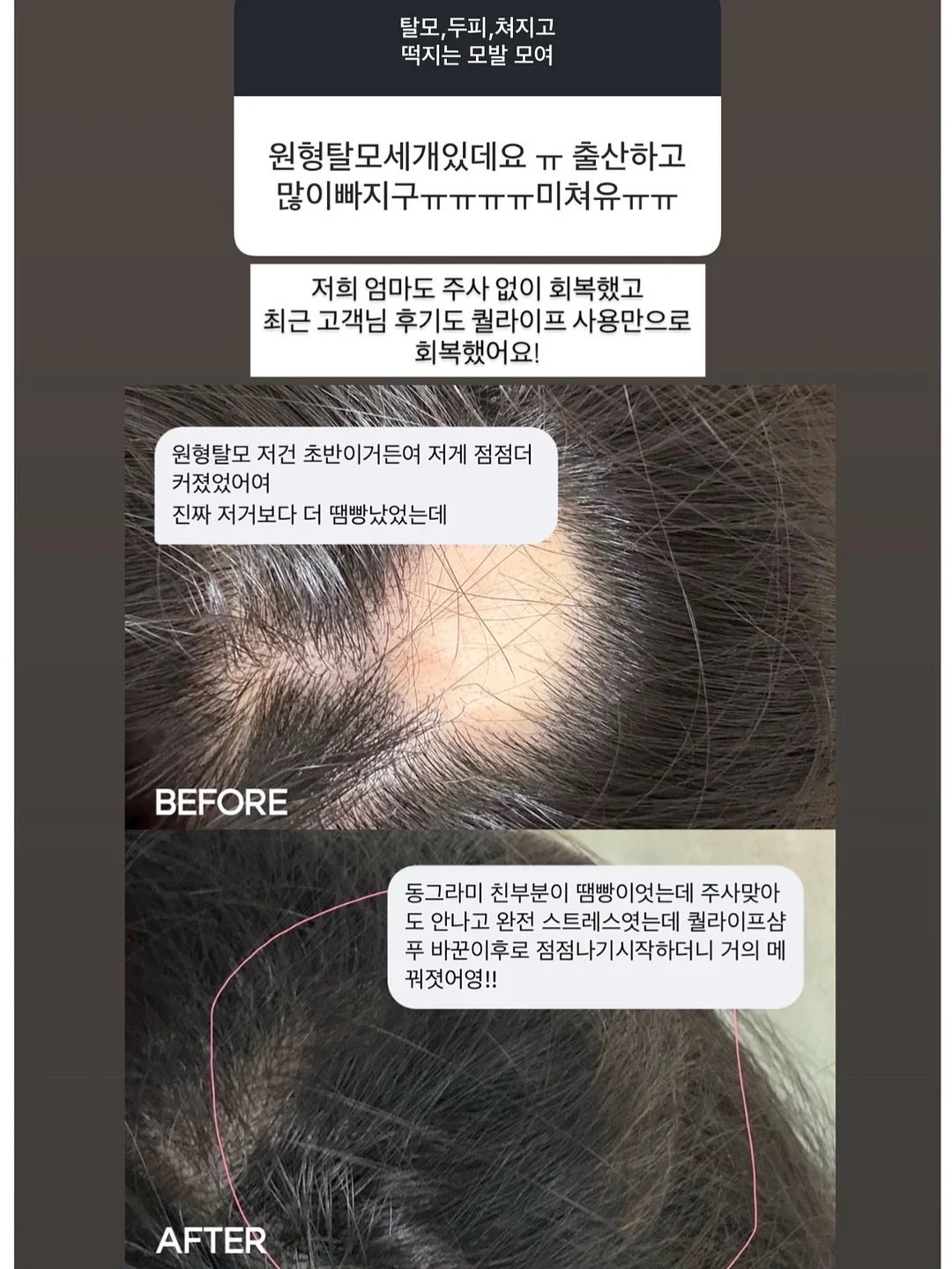 알론느 셔츠 5