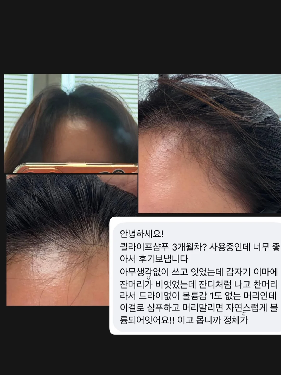 알론느 셔츠 6