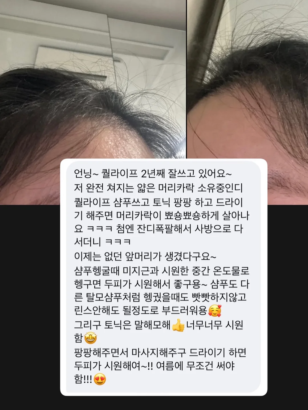 알론느 셔츠 7
