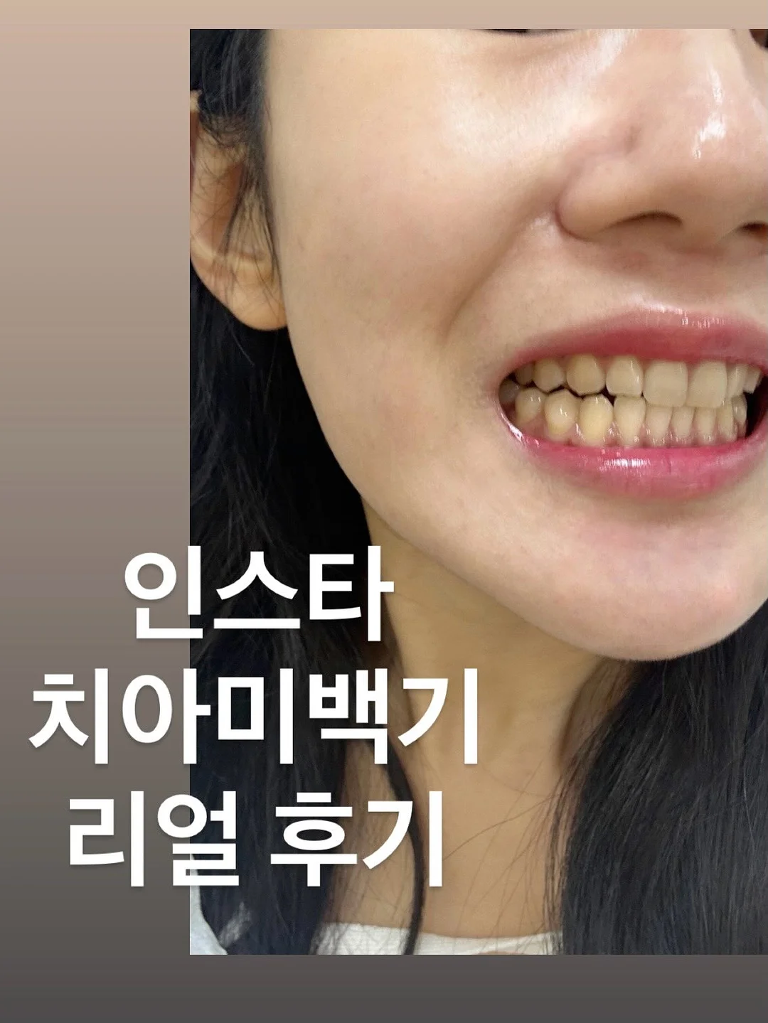 안마의자 1
