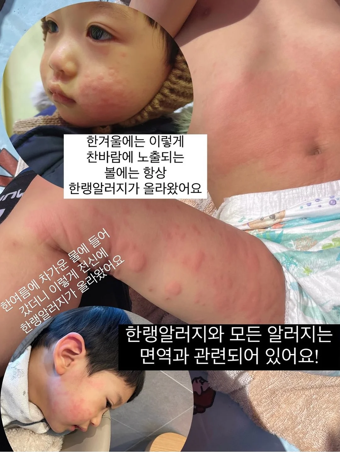 저당 고추장 제육 2