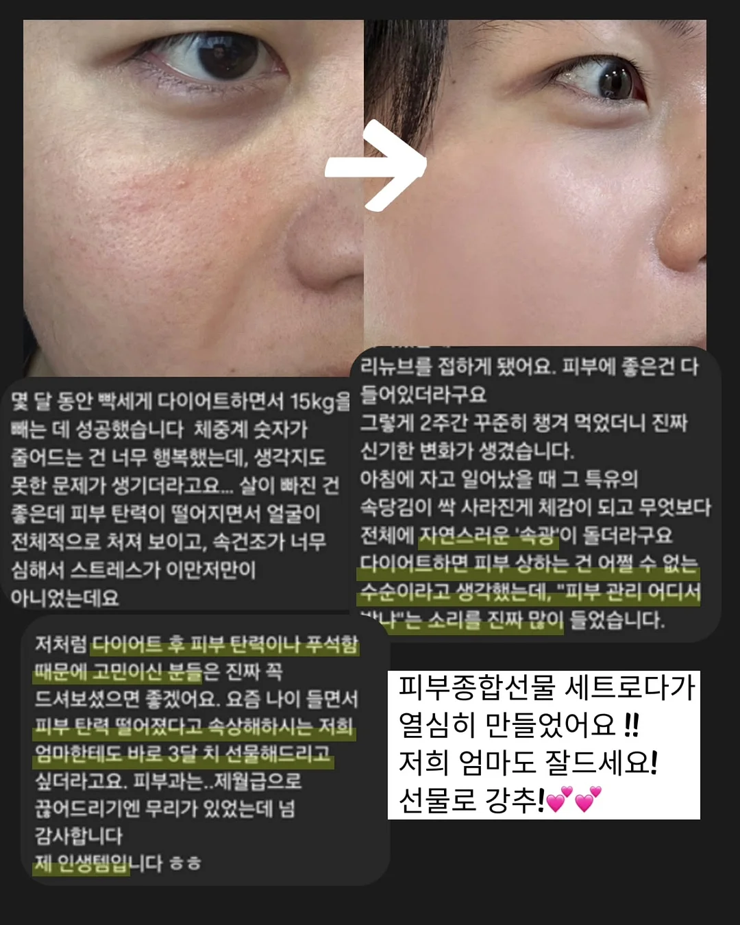 태양 차단 그늘막 6