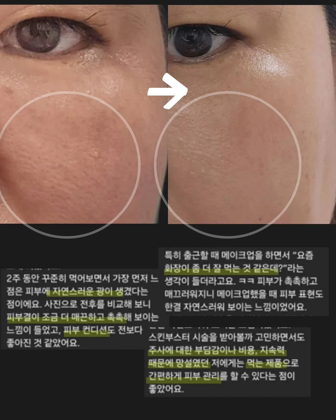태양 차단 그늘막 9