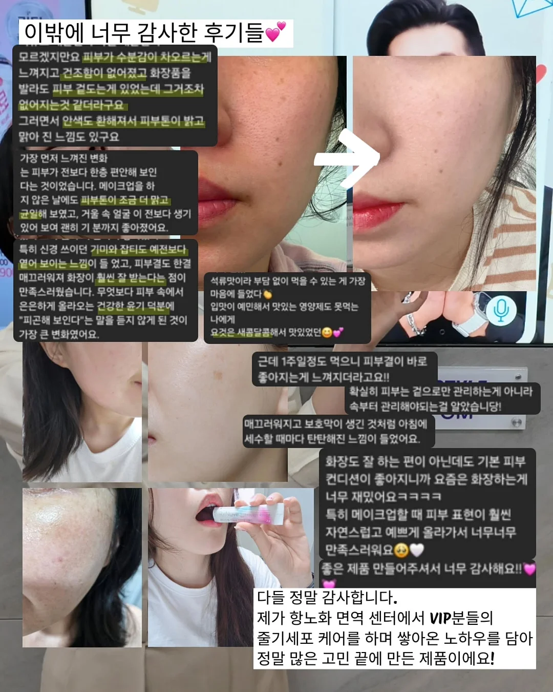 태양 차단 그늘막 10