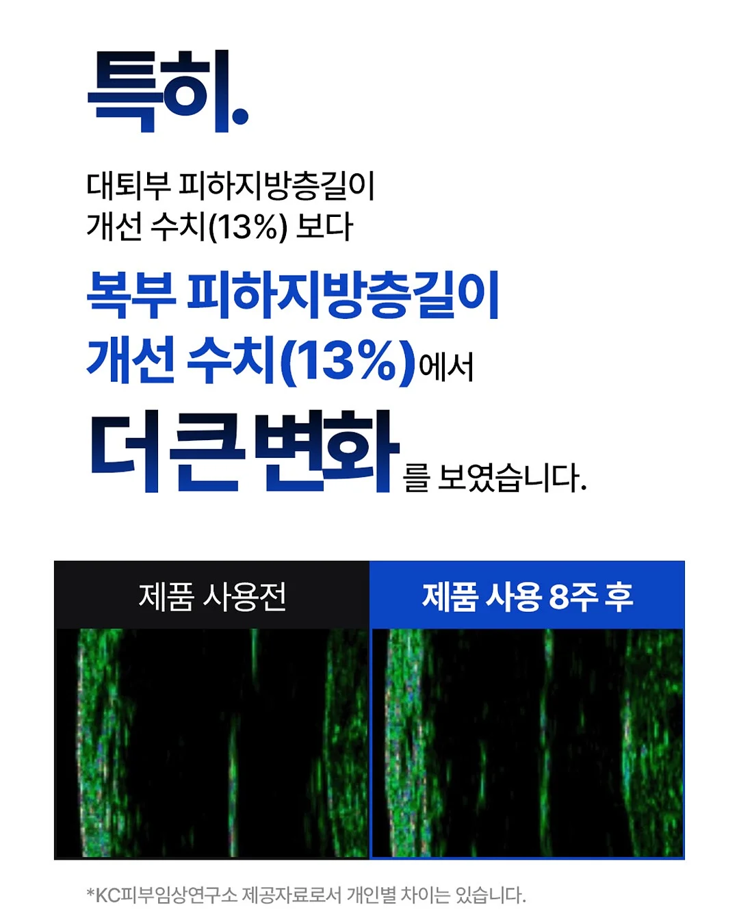 스파이더맨 웹슈터 14