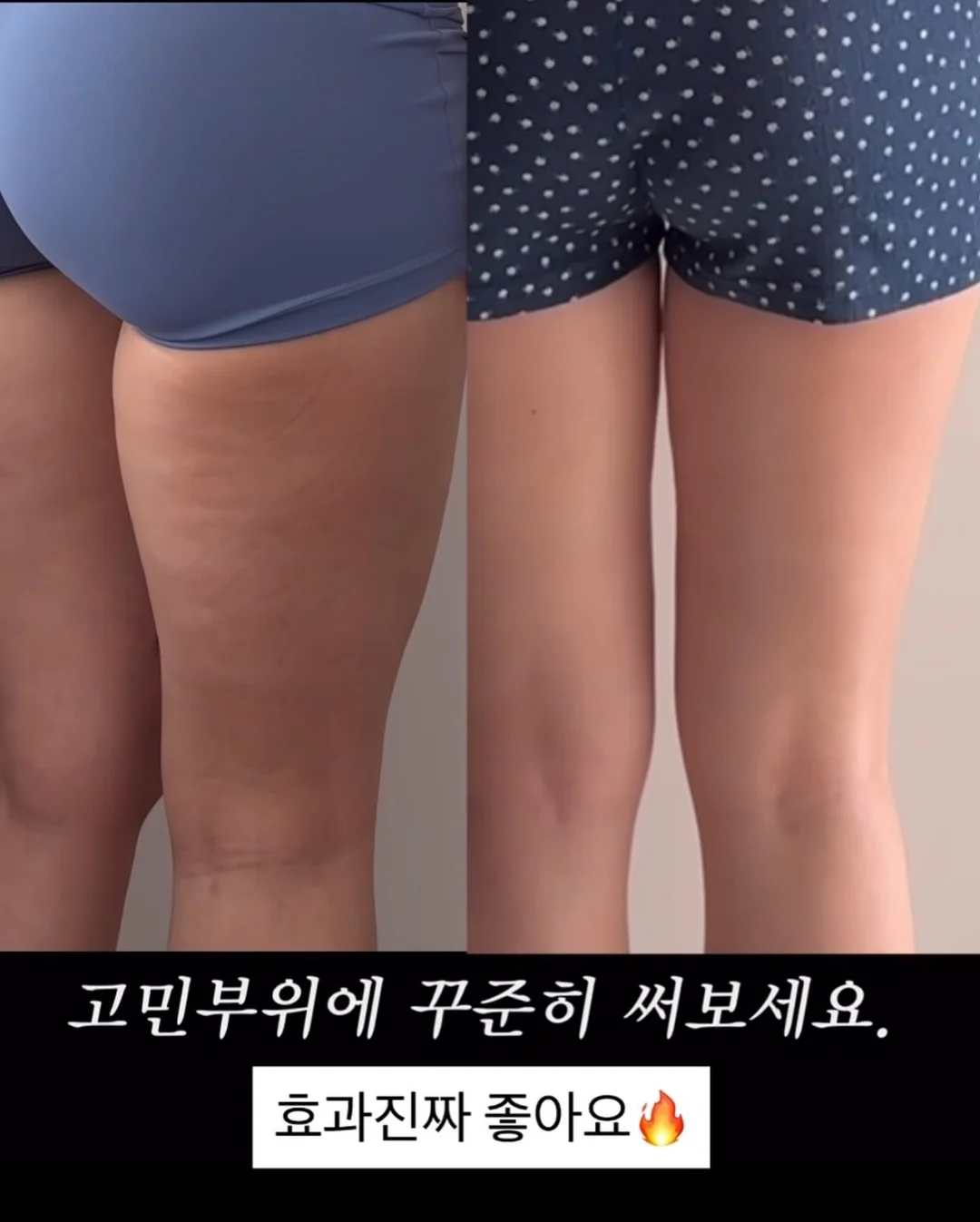 스파이더맨 웹슈터 20