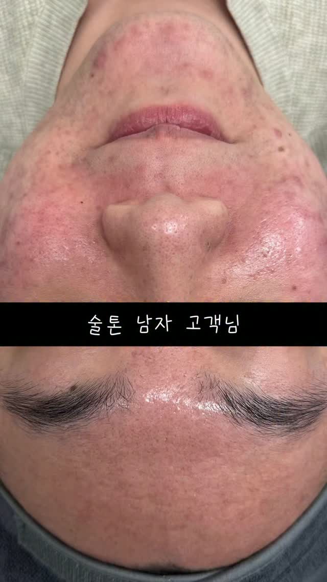 알엑스퍼트 아쿠아 스프레드 선커버리