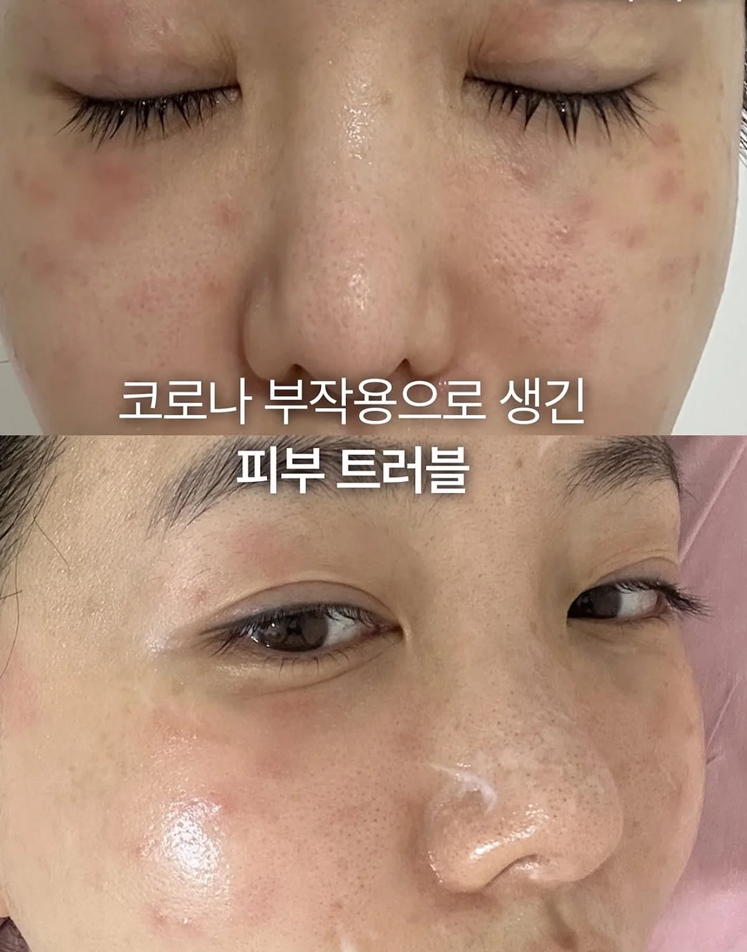 피치피치 여름고쟁이 2