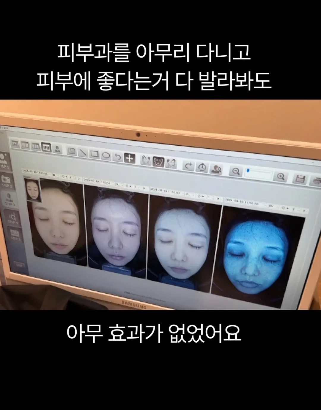 피치피치 여름고쟁이 3