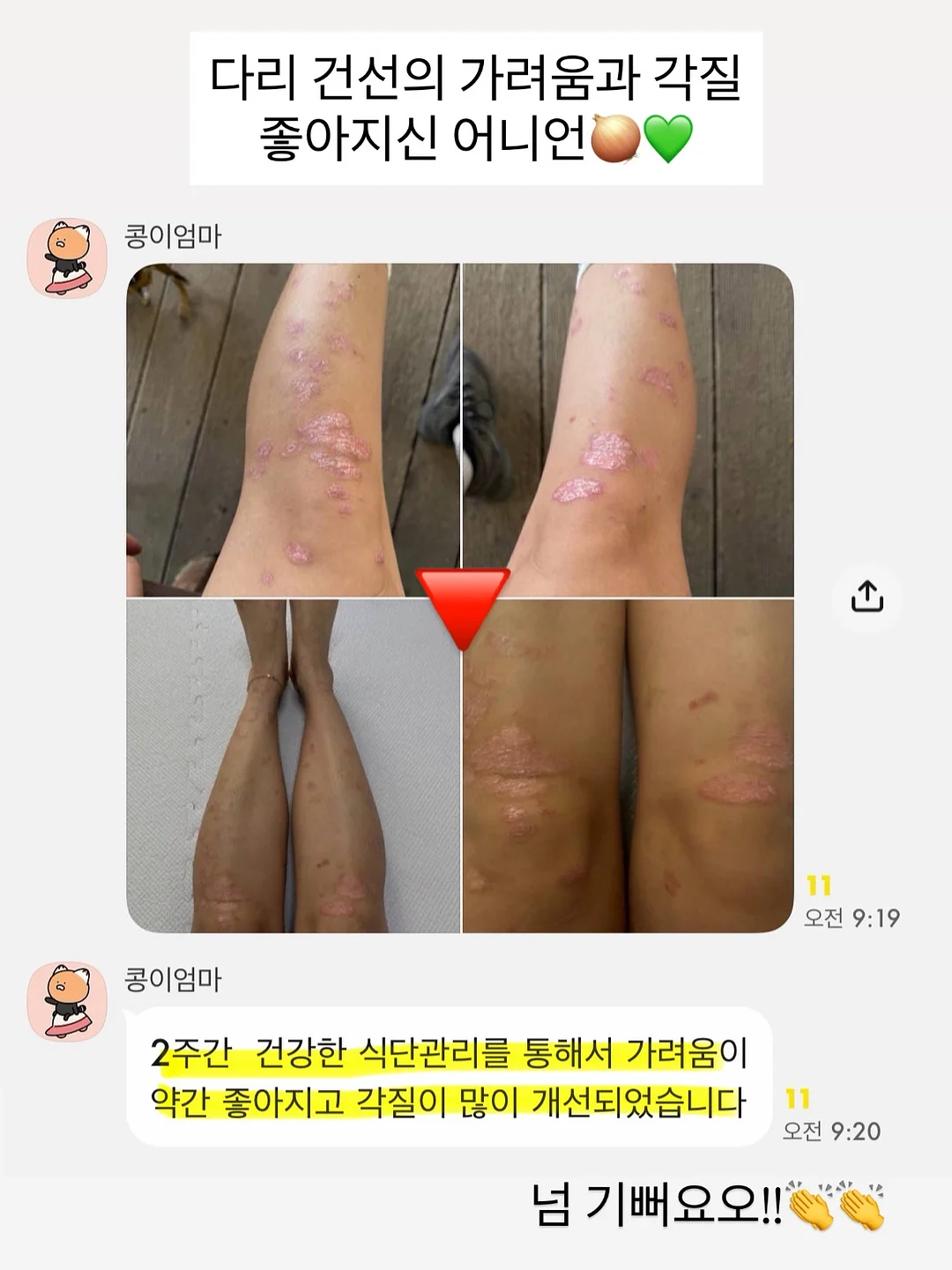 스니커즈 1