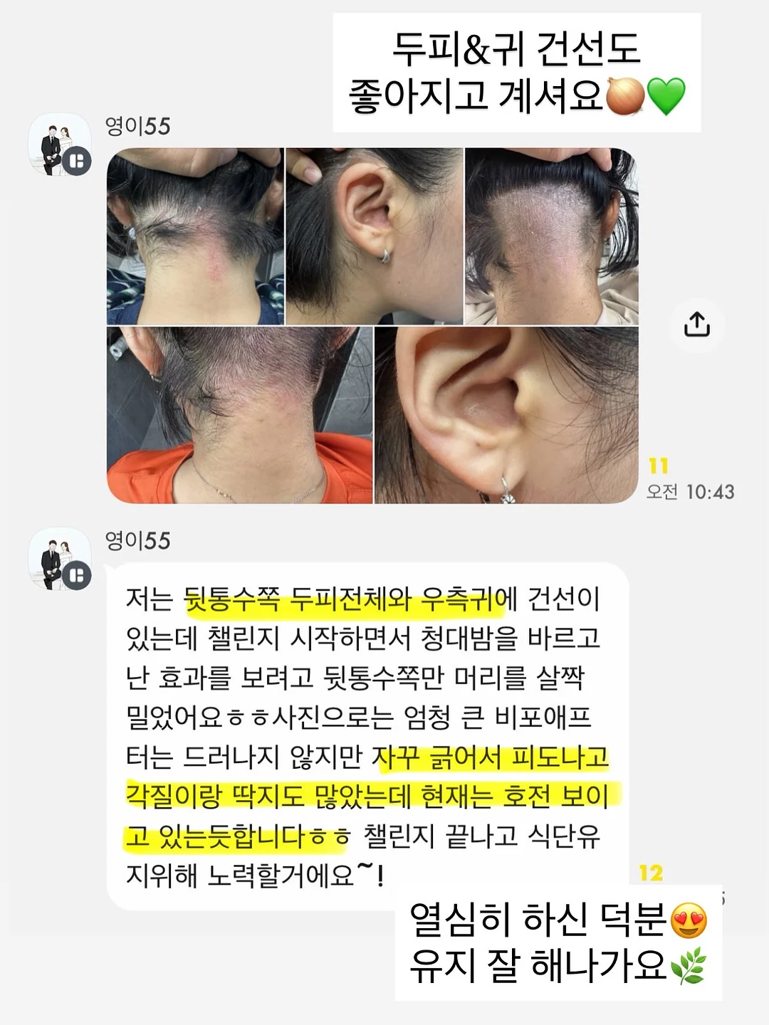 스니커즈 2