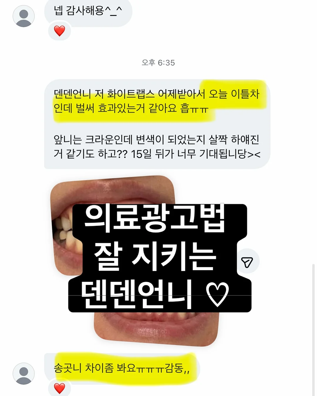 옛날 아이폰 13