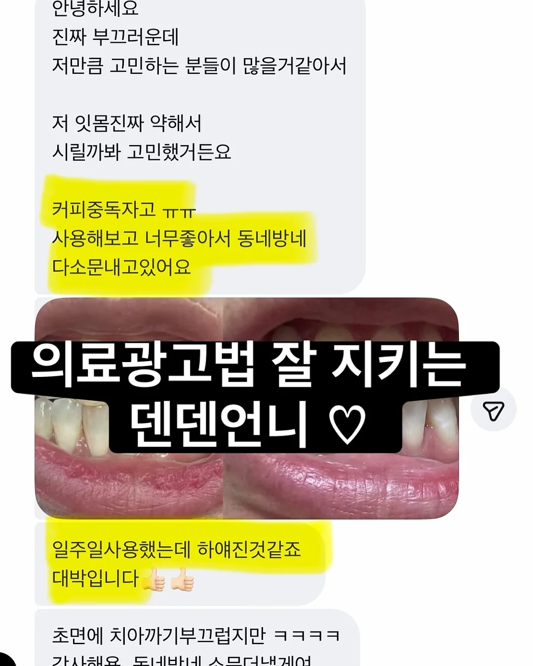 옛날 아이폰 10