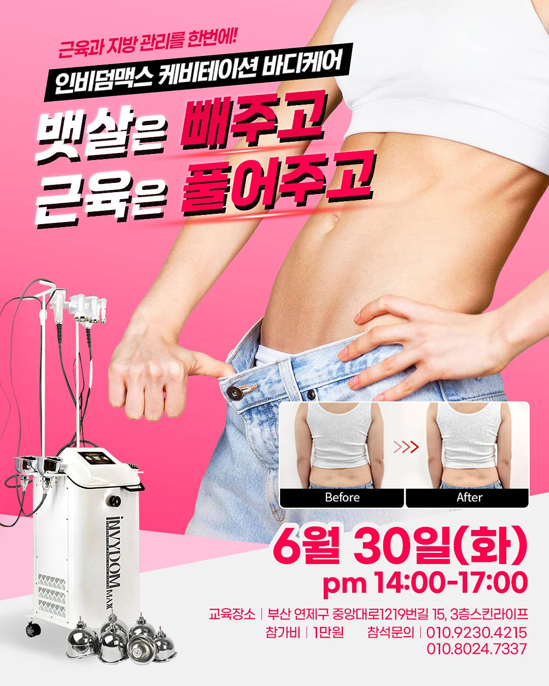 플리츠 옷 1