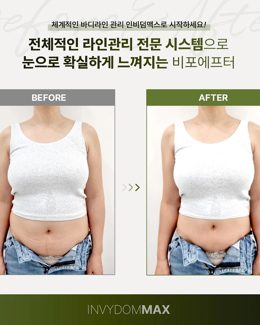 플리츠 옷 2