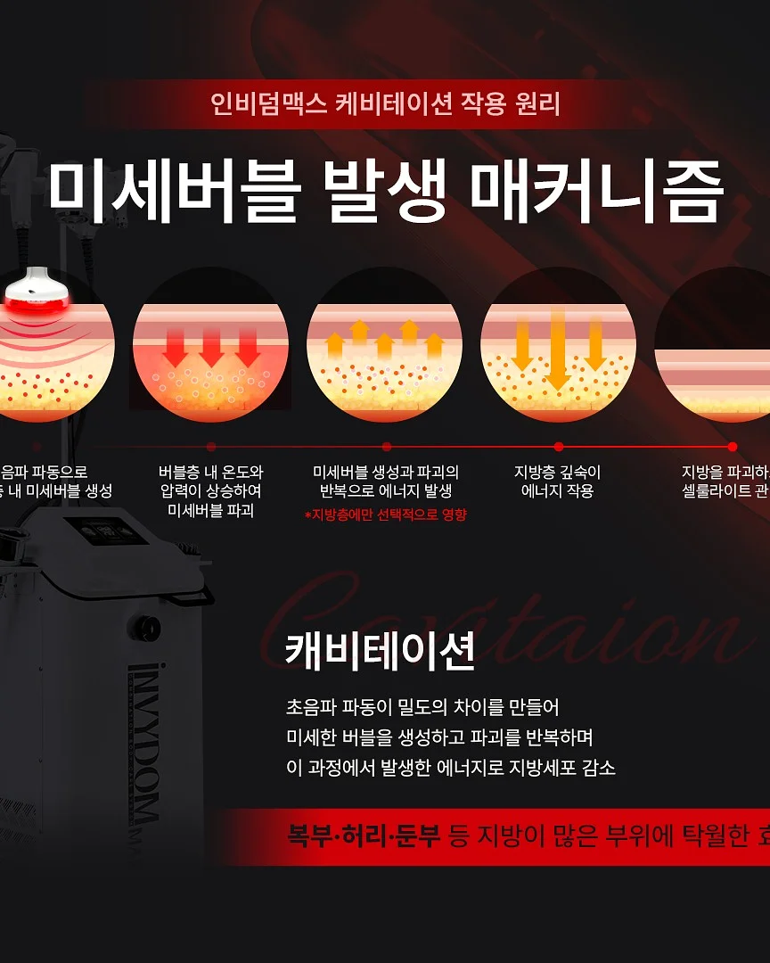 플리츠 옷 6